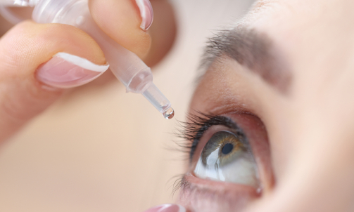 Woman,Drips,Eye,Drops,Into,Her,Eyes.,Eye,Diseases,And