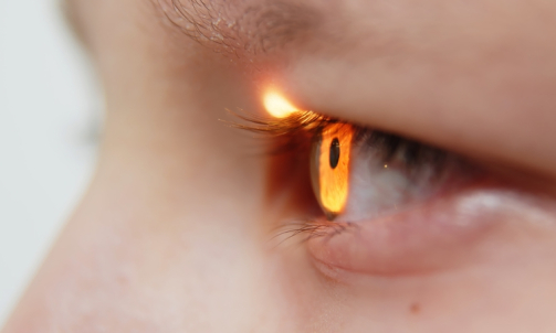 Close-up,Of,An,Eye.,Close-up,Of,An,Ophthalmological,Examination,In