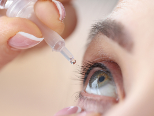 Woman,Drips,Eye,Drops,Into,Her,Eyes.,Eye,Diseases,And
