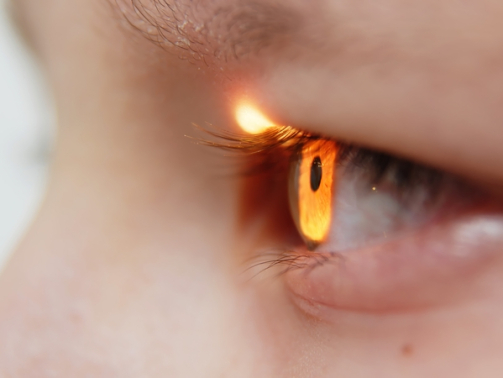 Close-up,Of,An,Eye.,Close-up,Of,An,Ophthalmological,Examination,In